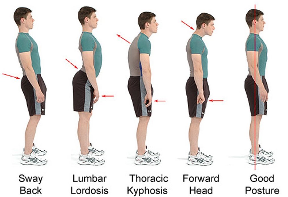 Exercises and tips to improve your posture