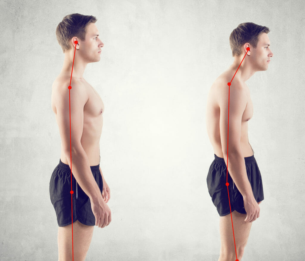 How To Fix Bad Posture - Your Back Pain Relief